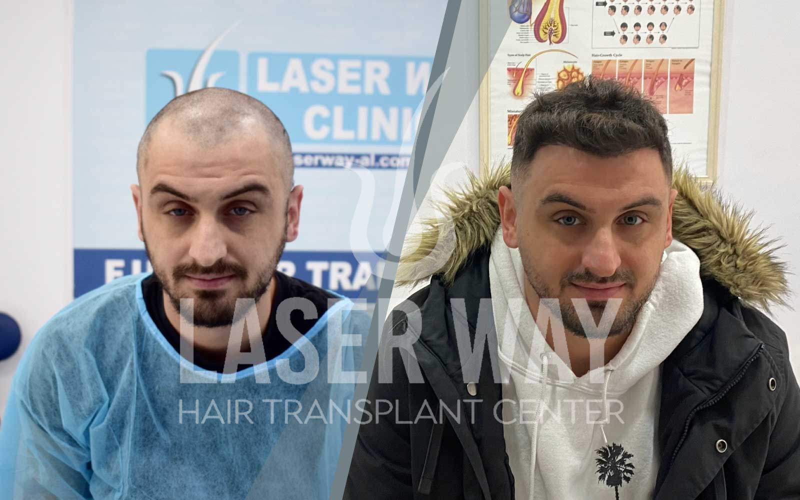 Foto Laser Way