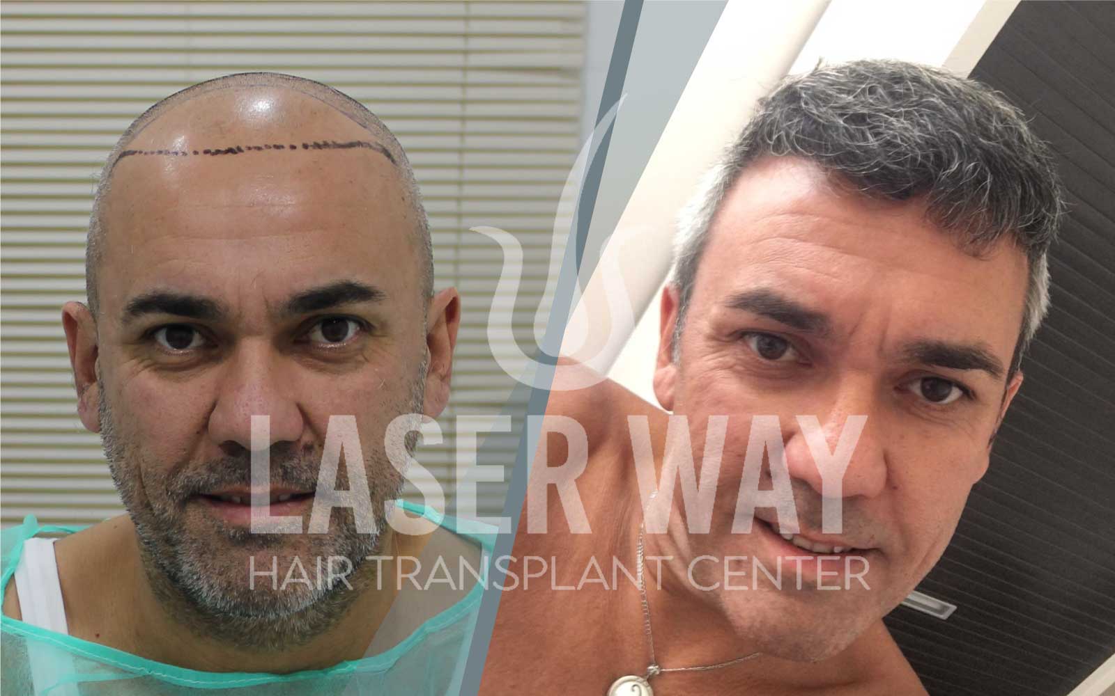 Foto Laser Way