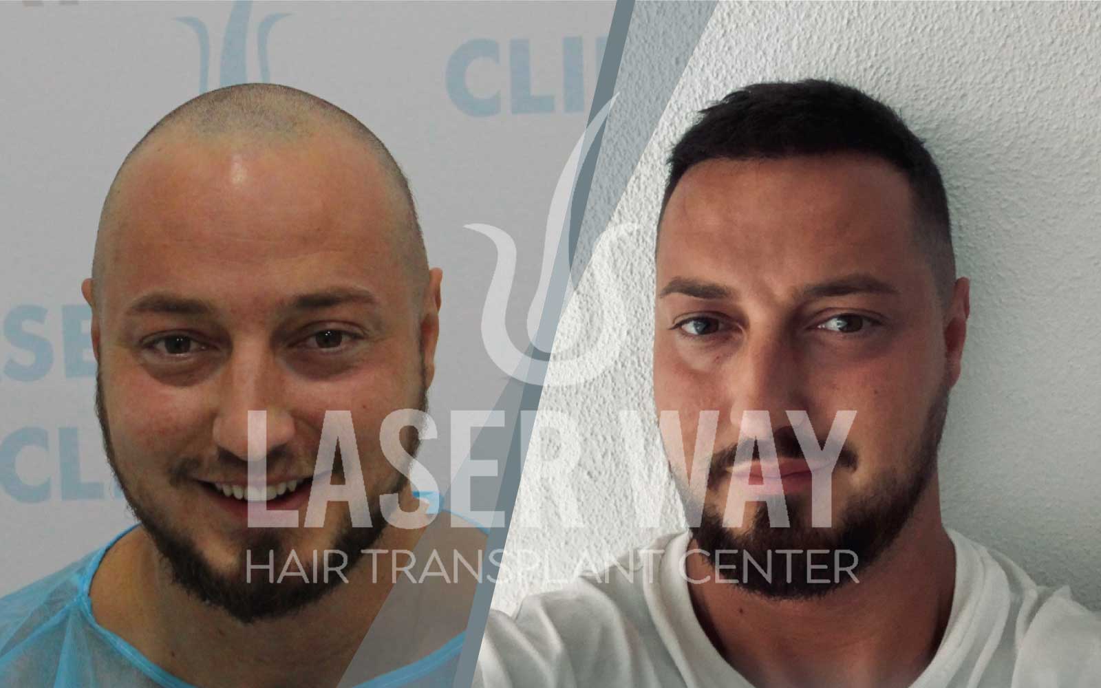 Foto Laser Way