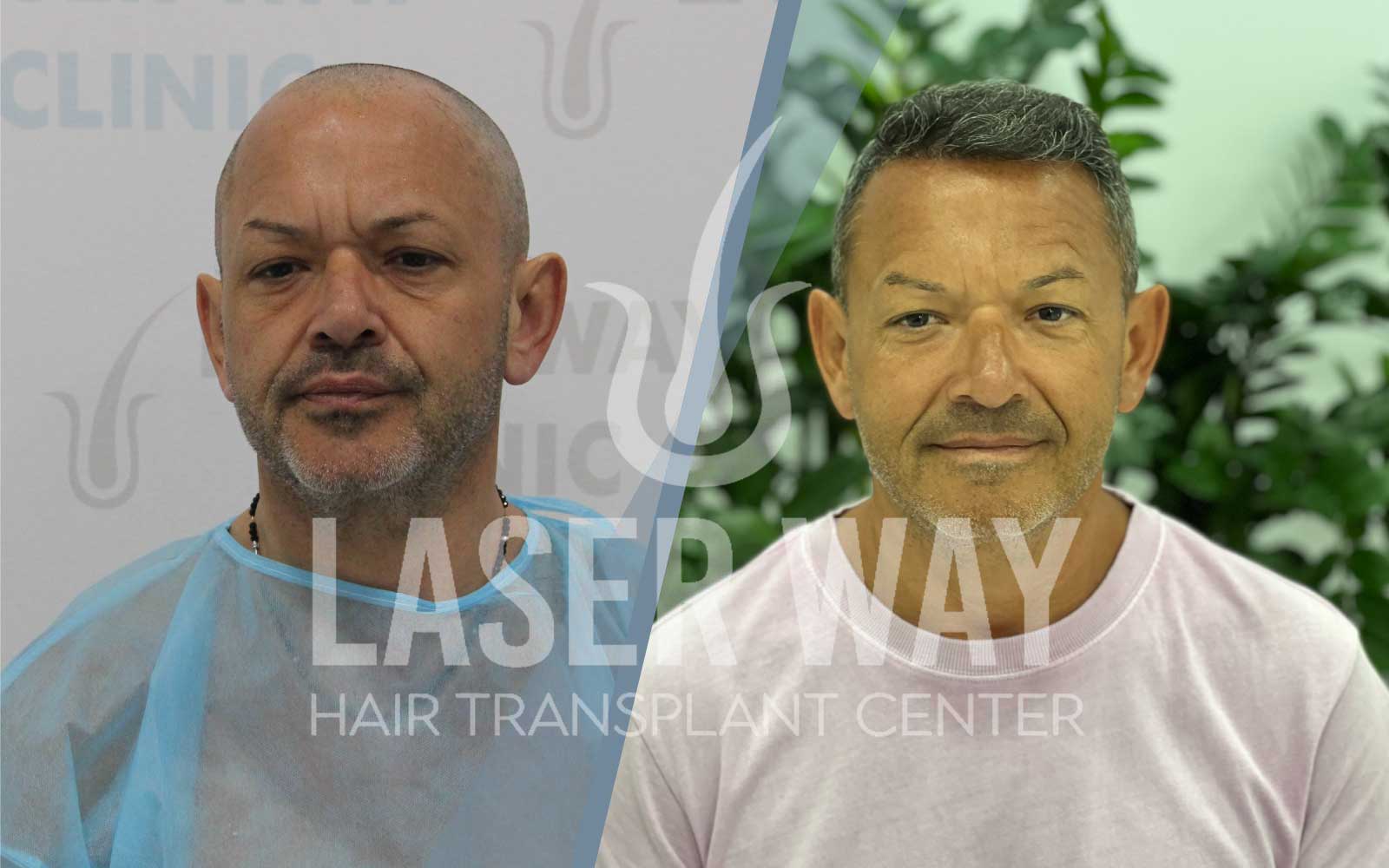 Foto Laser Way