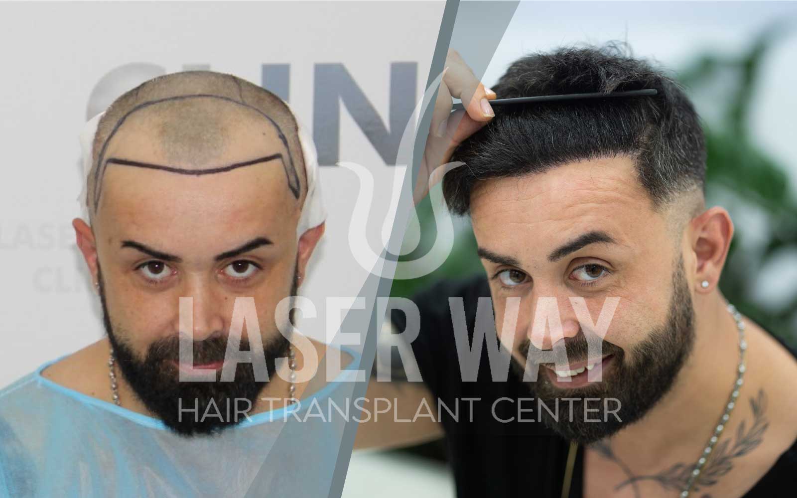 Foto Laser Way