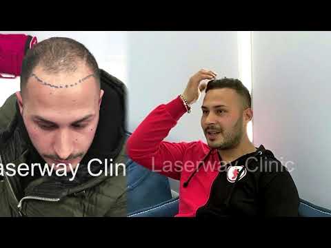 Testimonianza paziente Laser Way 3